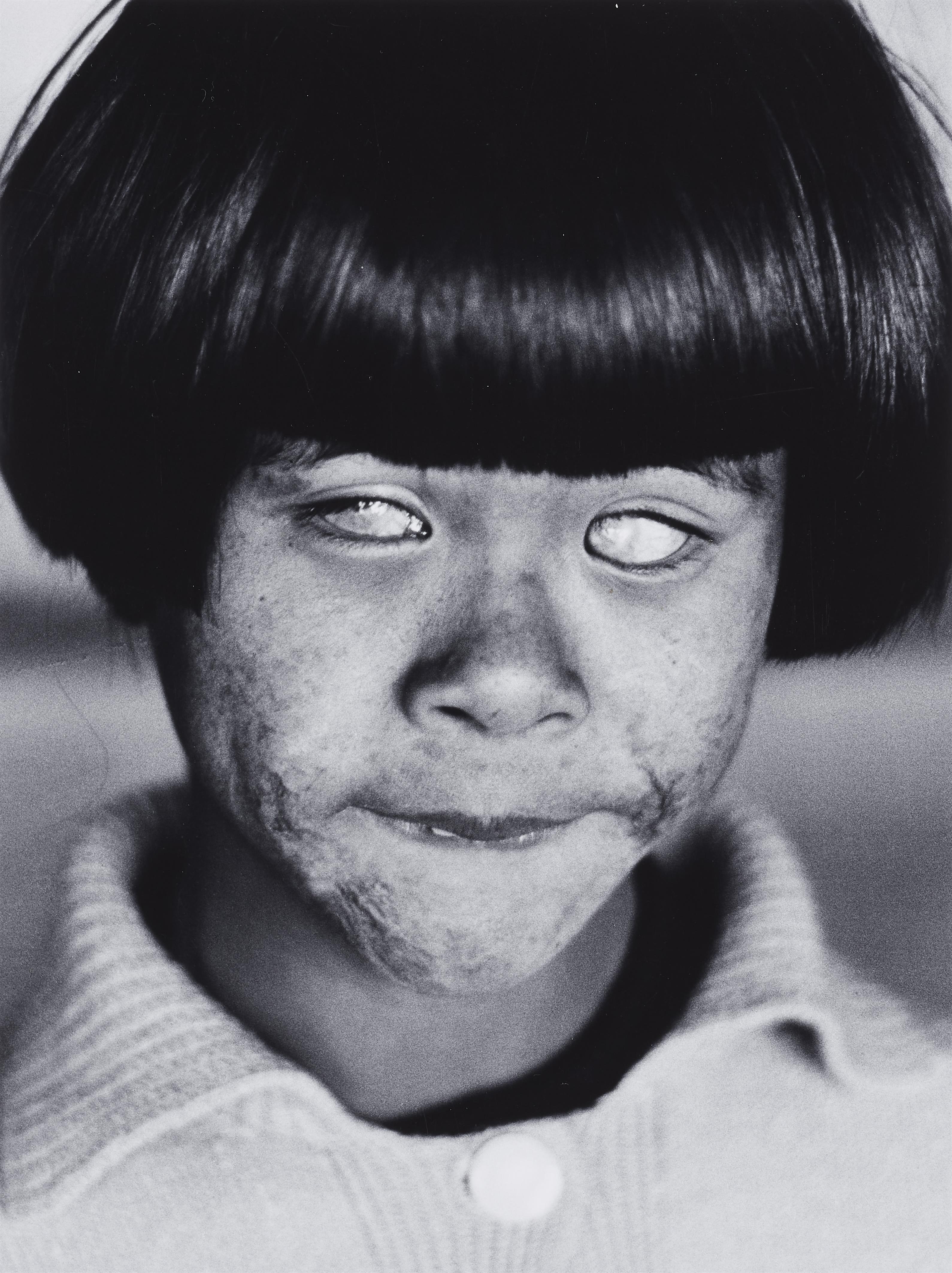 Christer Strömholm - The blind Girl, Hiroshima - image-1