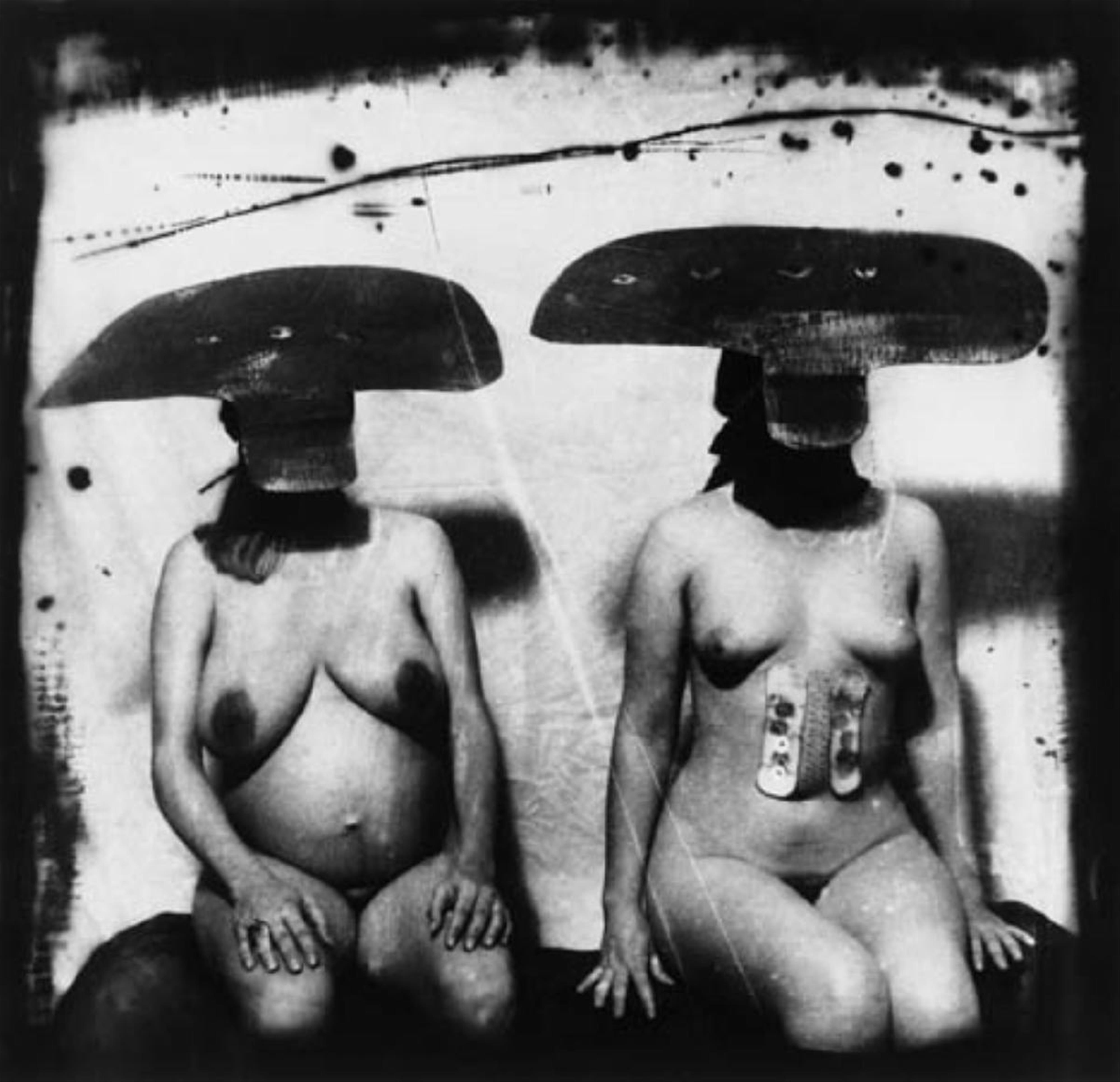Joel-Peter Witkin - I.D. Photograph from Purgatory: Two Women with Stomach Irritations - image-1