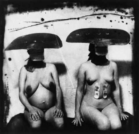 Joel-Peter Witkin - I.D. Photograph from Purgatory: Two Women with Stomach Irritations